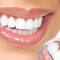 Протезирование зубов - Шингарева врач стоматолог, Новоуральск, зубнойболи.net, стоматолог и я
